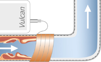 rdeuction-rouille-1.jpg